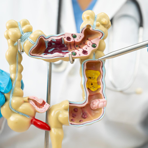 clinica fluence – endoscopia em bh – especialidade proctologia clinica fluence - endoscopia em bh - especialidade proctologia